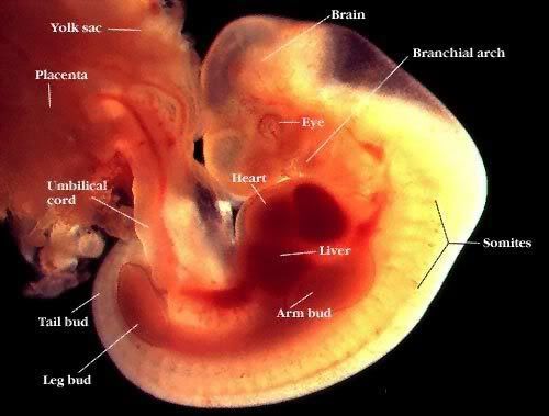 miscarriage at 7 weeks. in miscarriage, weeks